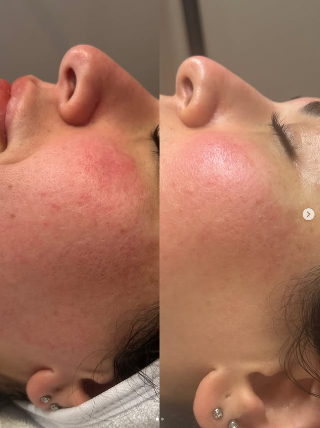 Welche Behandlung passt zu meiner Haut? von Aura Kosmetik