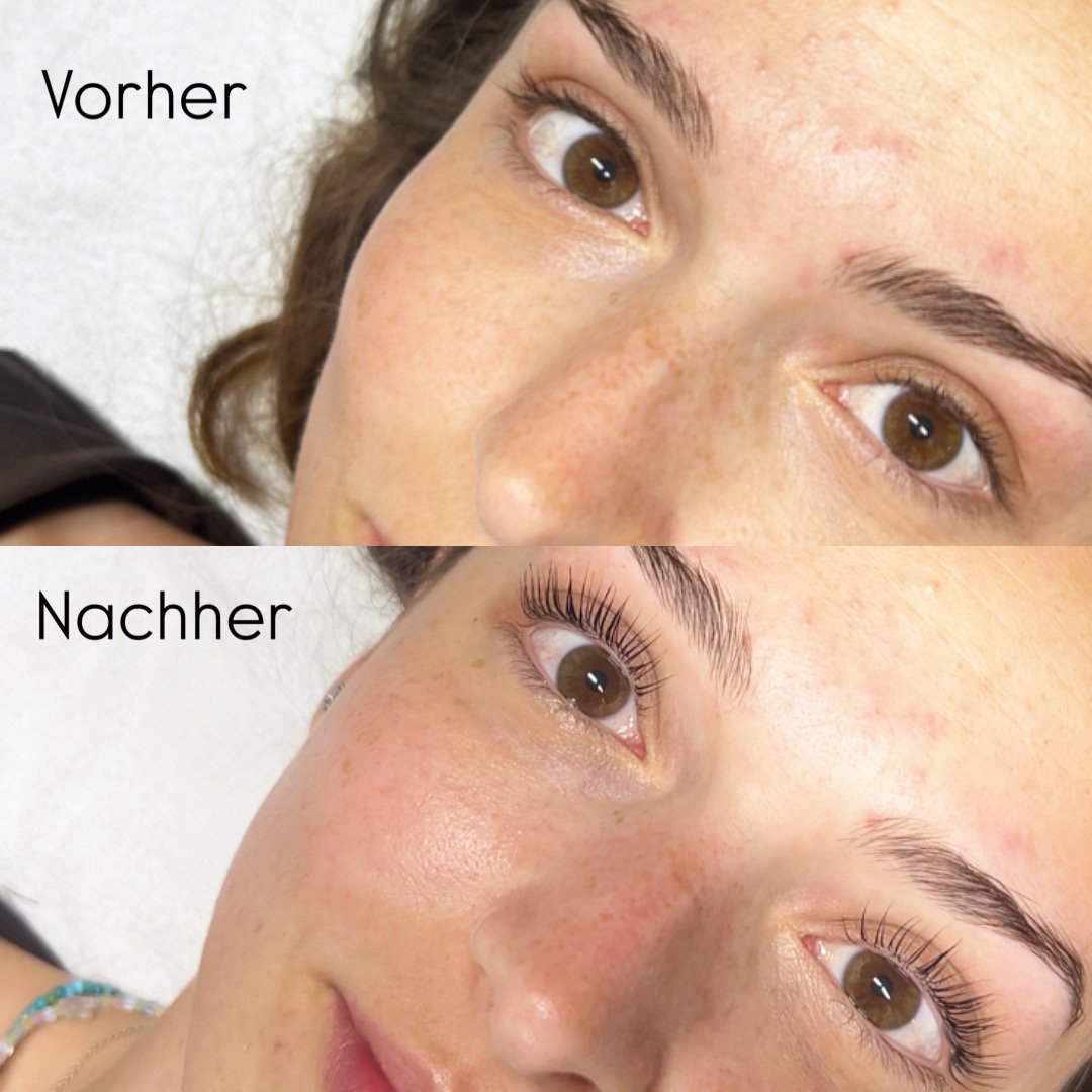 Ergebnis der Hautbehandlung